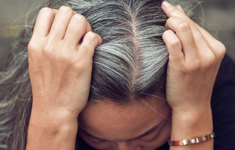 Erken yaşta saç beyazlatan nedenler ve alınacak önlemler