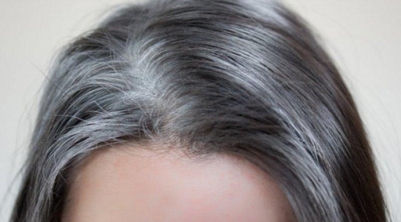 Erken yaşta saç beyazlatan nedenler ve alınacak önlemler