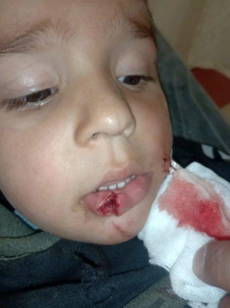 Sokak köpeklerinin görünmeyen yüzü: 20 üzücü saldırı