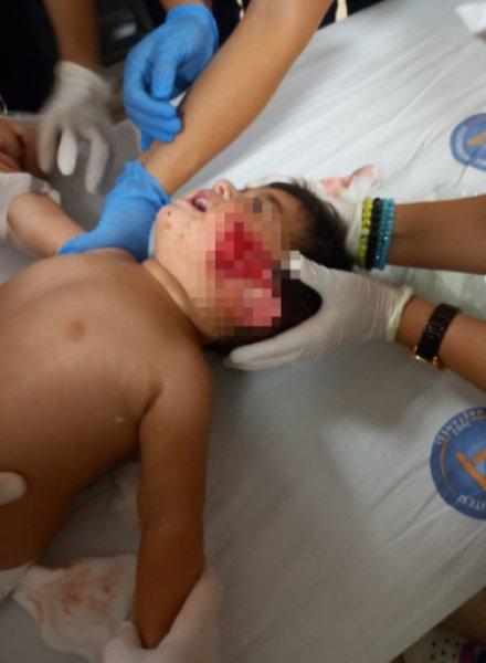 Sokak köpeklerinin görünmeyen yüzü: 20 üzücü saldırı