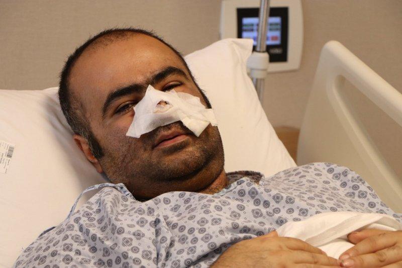 Sokak köpeklerinin görünmeyen yüzü: 20 üzücü saldırı