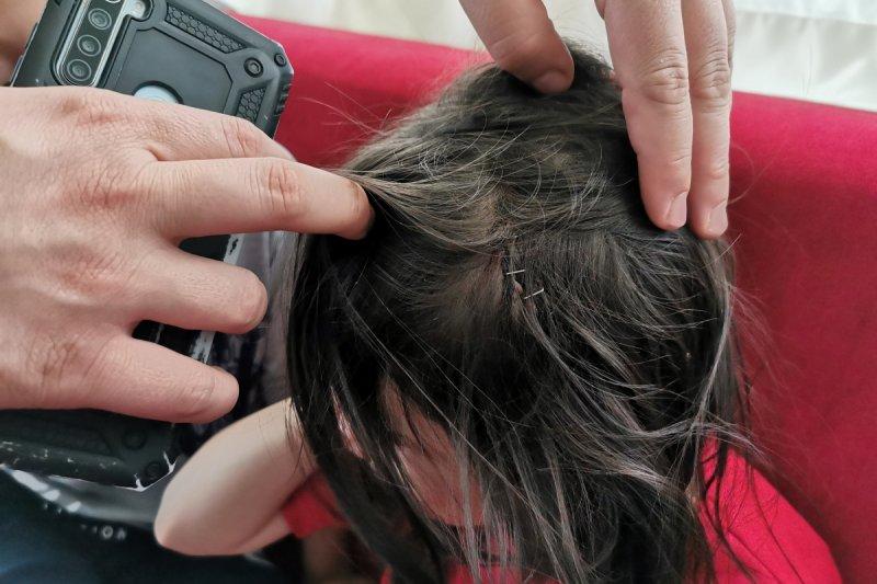 Sokak köpeklerinin görünmeyen yüzü: 20 üzücü saldırı