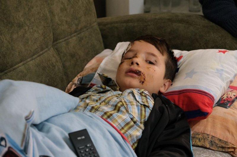 Sokak köpeklerinin görünmeyen yüzü: 20 üzücü saldırı