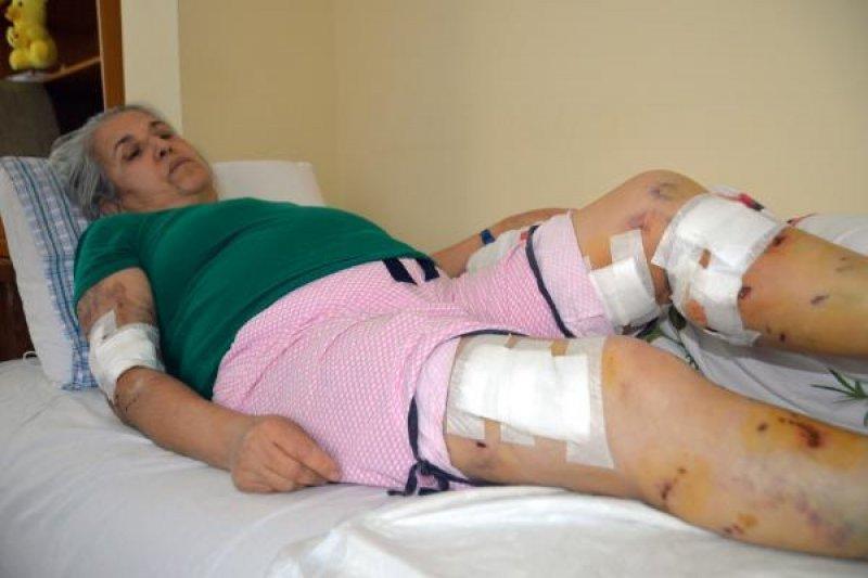 Sokak köpeklerinin görünmeyen yüzü: 20 üzücü saldırı