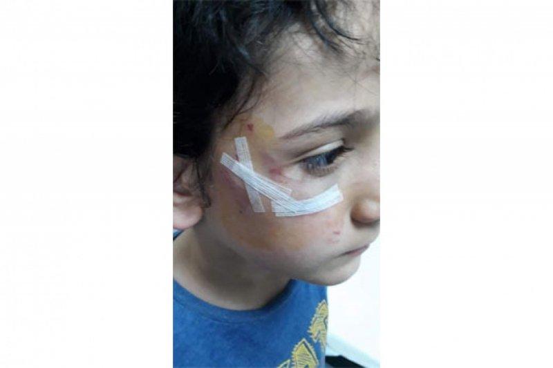 Sokak köpeklerinin görünmeyen yüzü: 20 üzücü saldırı