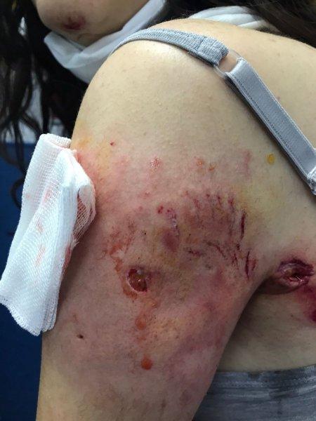 Sokak köpeklerinin görünmeyen yüzü: 20 üzücü saldırı