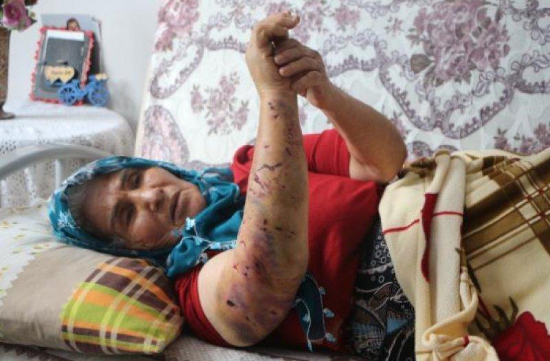 Sokak köpeklerinin görünmeyen yüzü: 20 üzücü saldırı