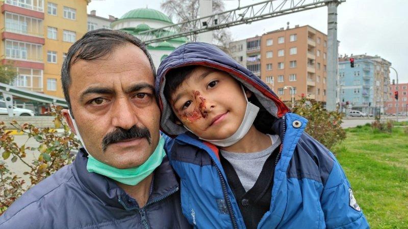 Sokak köpeklerinin görünmeyen yüzü: 20 üzücü saldırı