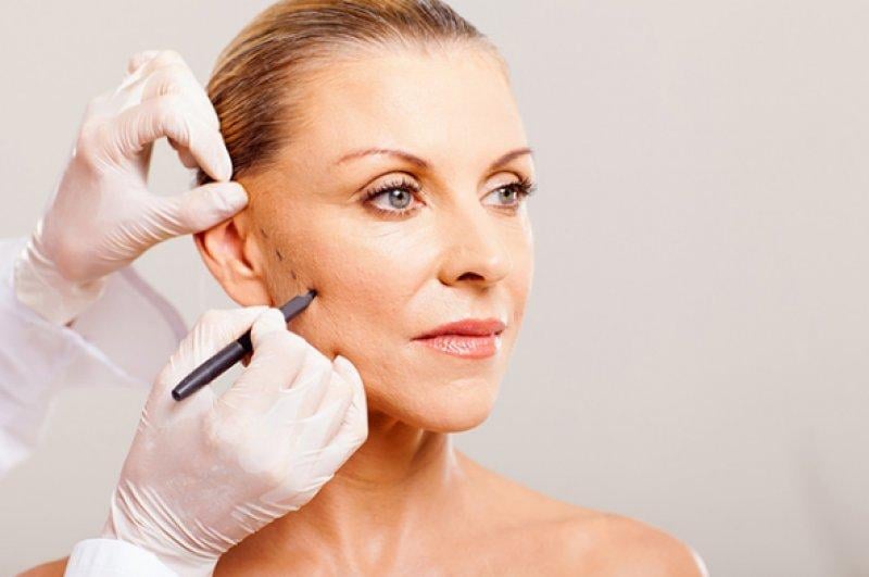 Fransız Askısı yaptıran ünlüler