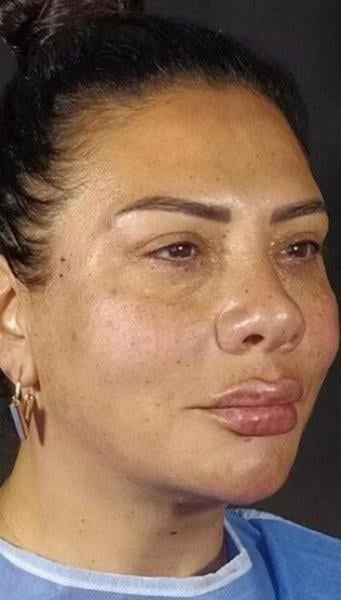 Fransız Askısı yaptıran ünlüler