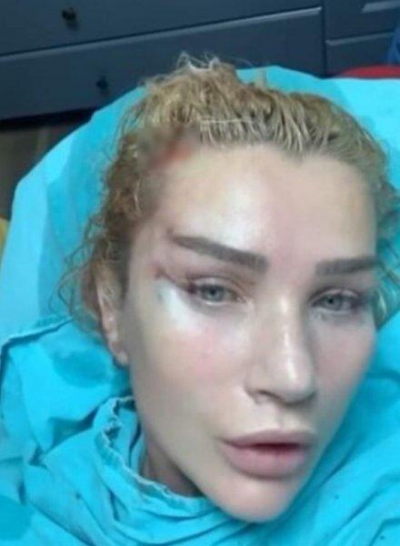 Fransız Askısı yaptıran ünlüler