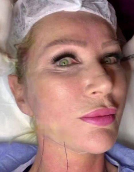 Fransız Askısı yaptıran ünlüler