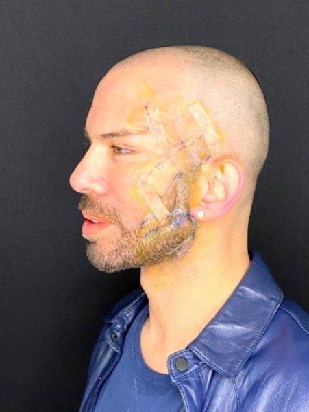 Fransız Askısı yaptıran ünlüler