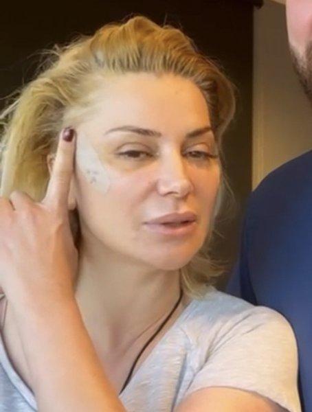 Fransız Askısı yaptıran ünlüler