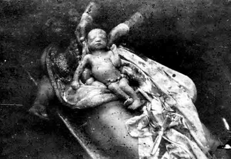 Hocalı katliamı üzerinden 30 yıl geçti