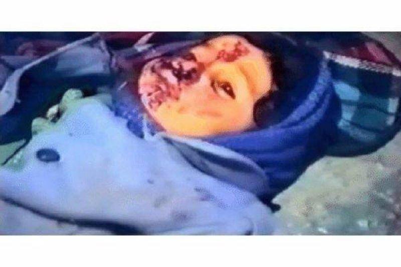 Hocalı katliamı üzerinden 30 yıl geçti