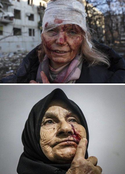 Ukrayna-Rusya savaşında kadraja giren manzaralar değişmedi