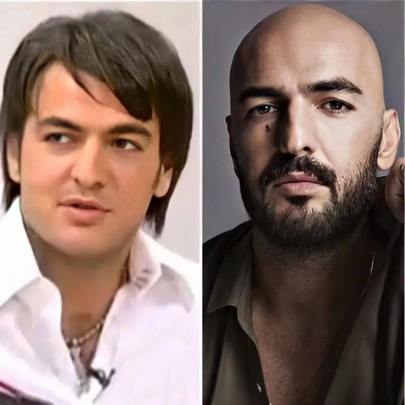 Soner Sarıkabadayı’nın uzun saçlı hali