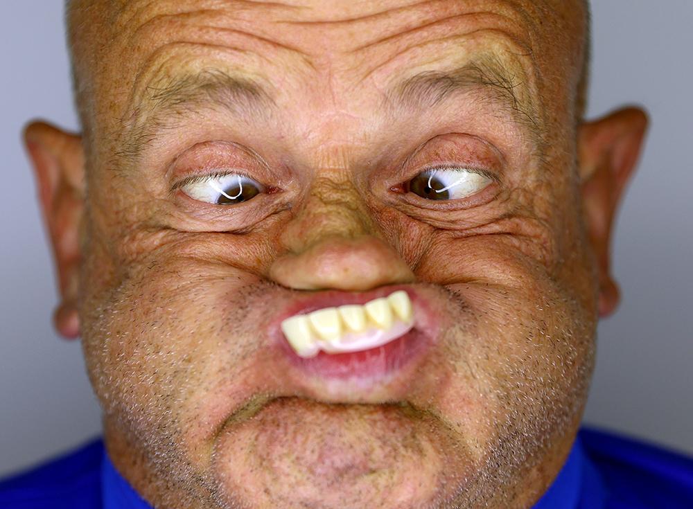 En çirkin yüz yarışması