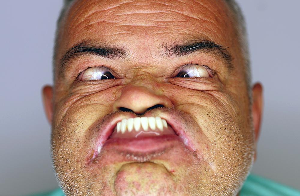 En çirkin yüz yarışması