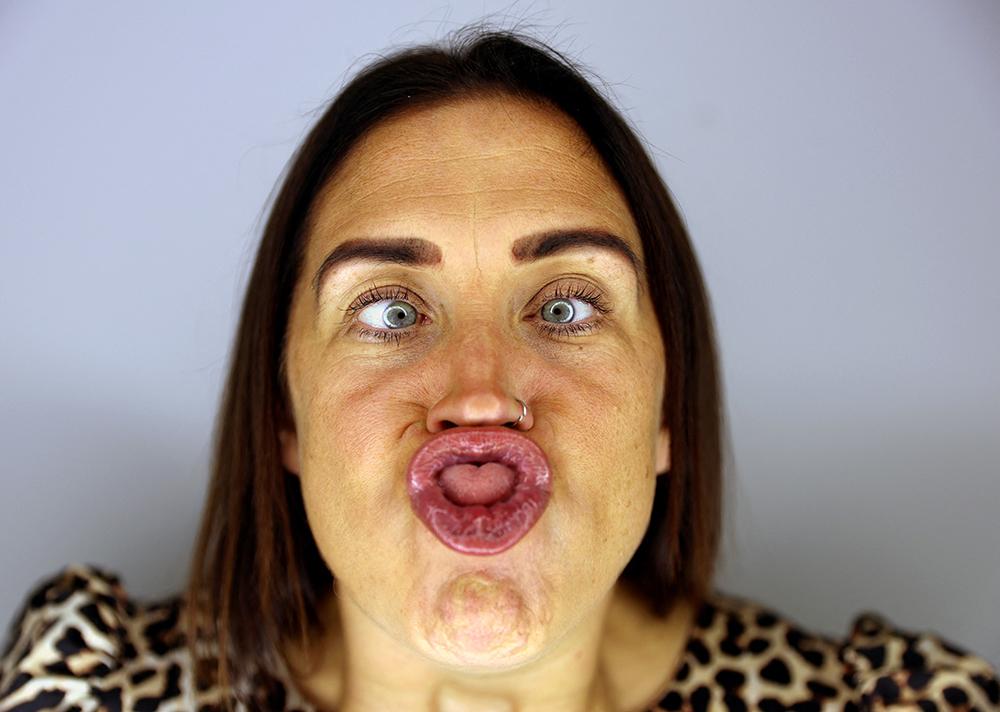 En çirkin yüz yarışması