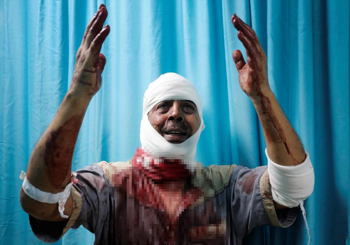 Saldırılarla geçen 40. gün: Gazze'de son durum...