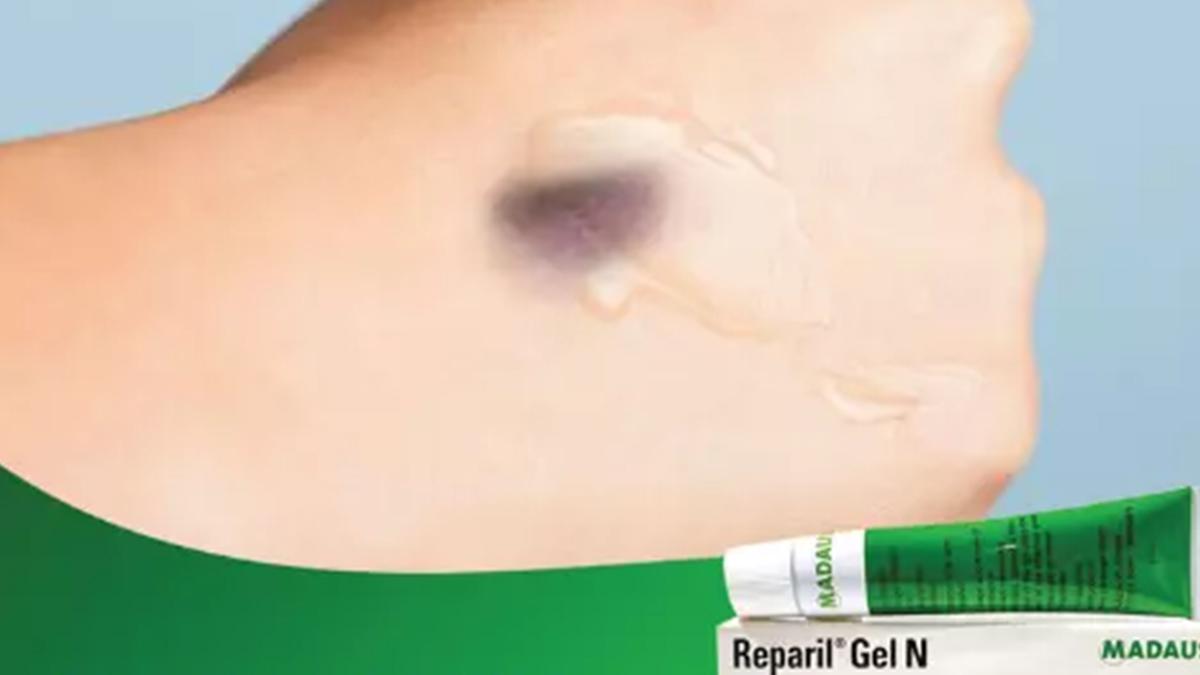 Reparil jel ne işe yarıyor? İşte Reparil jel kullanımı ve fiyatı 2024