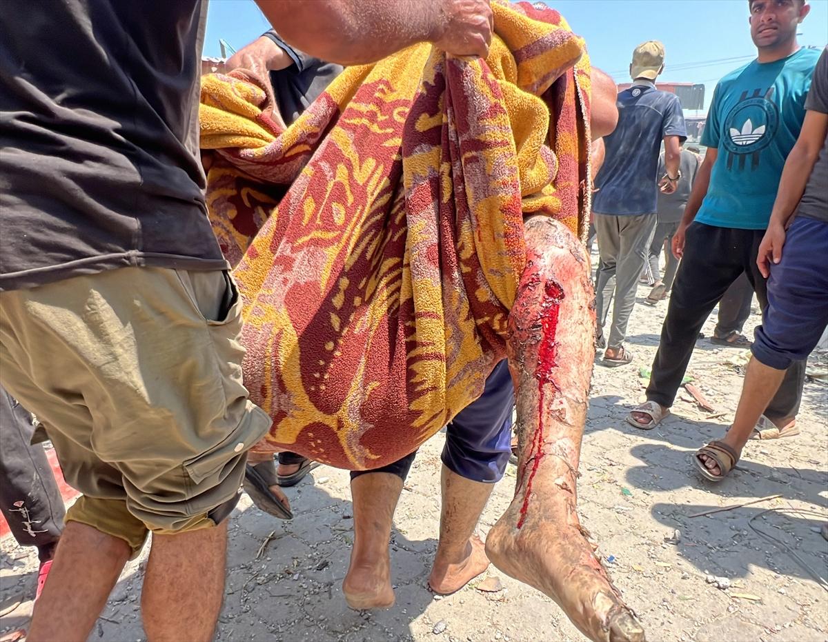 İsrail, sahra hastanesini bombaladı: 31 ölü