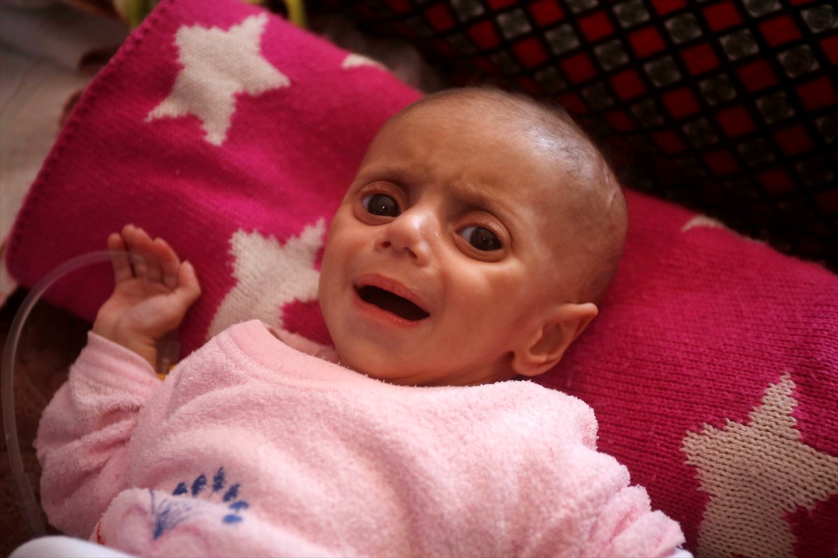 Gazze'de acı tablo: Açlık krizi derinleşiyor