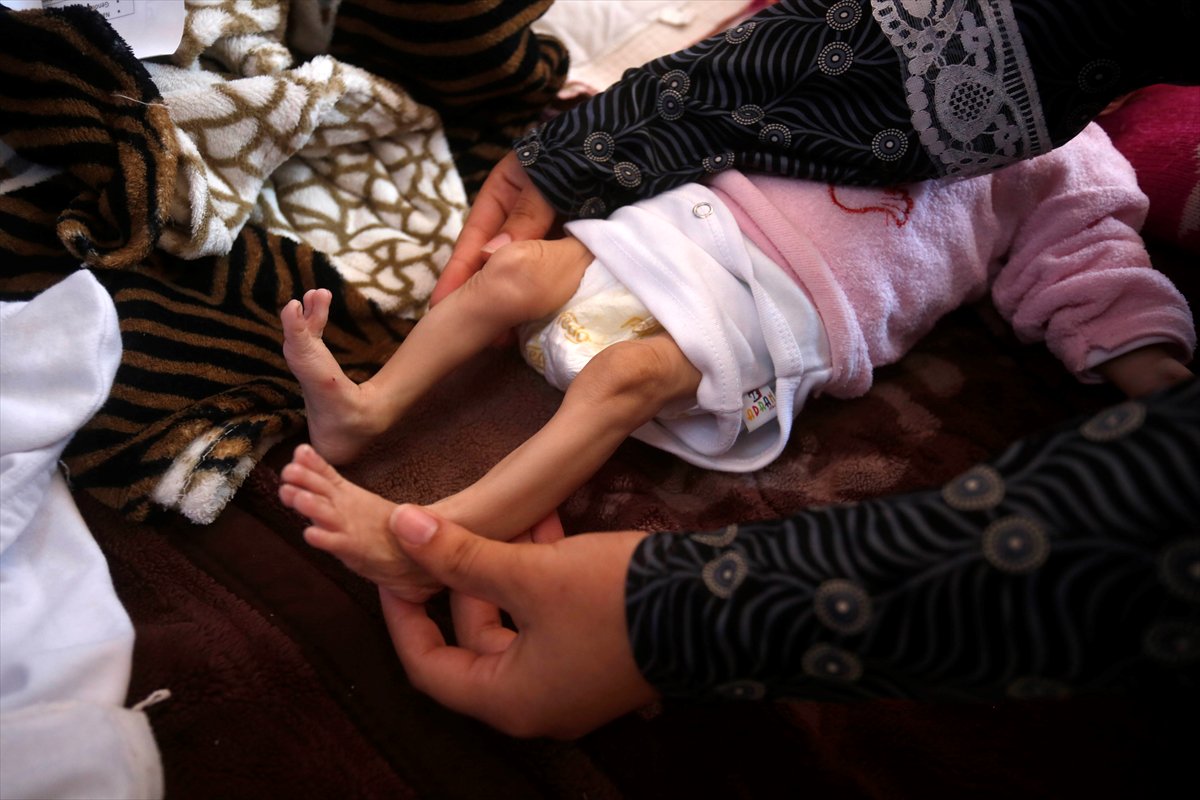 Gazze'de acı tablo: Açlık krizi derinleşiyor