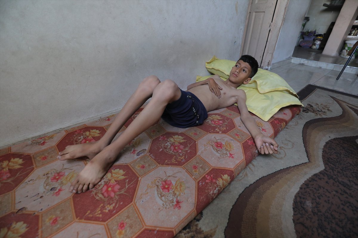 Gazze'de acı tablo: Açlık krizi derinleşiyor