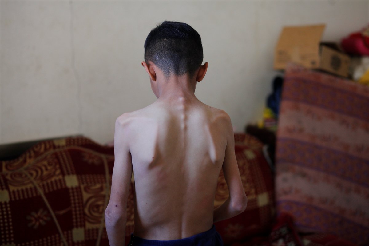 Gazze'de acı tablo: Açlık krizi derinleşiyor