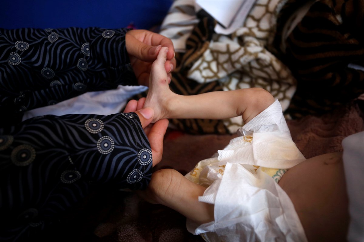 Gazze'de acı tablo: Açlık krizi derinleşiyor