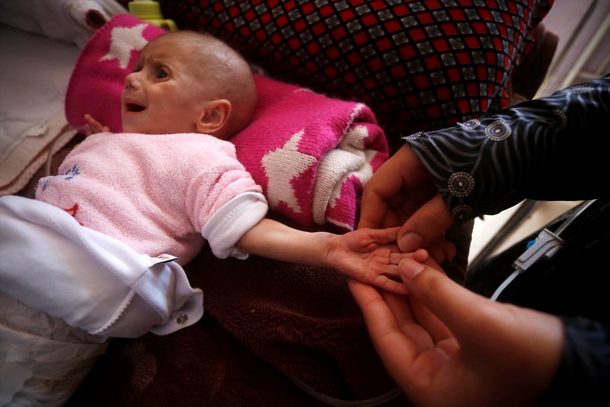 Gazze'de acı tablo: Açlık krizi derinleşiyor