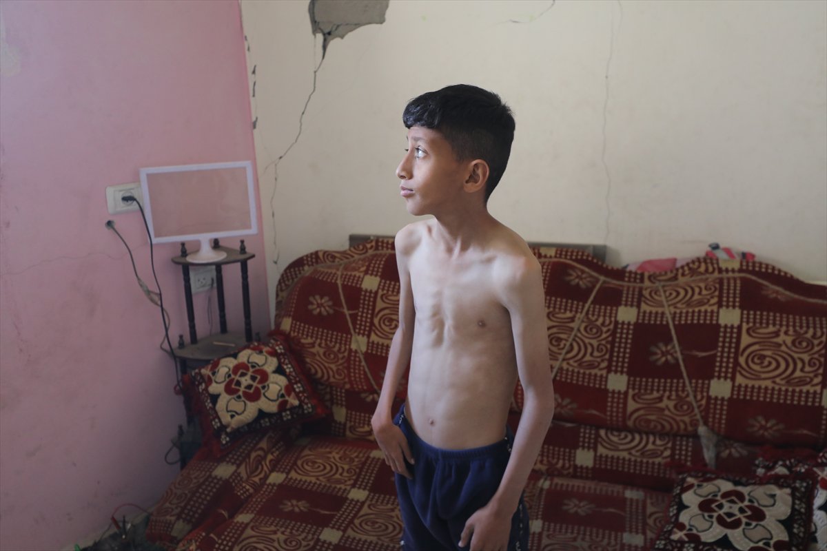 Gazze'de acı tablo: Açlık krizi derinleşiyor