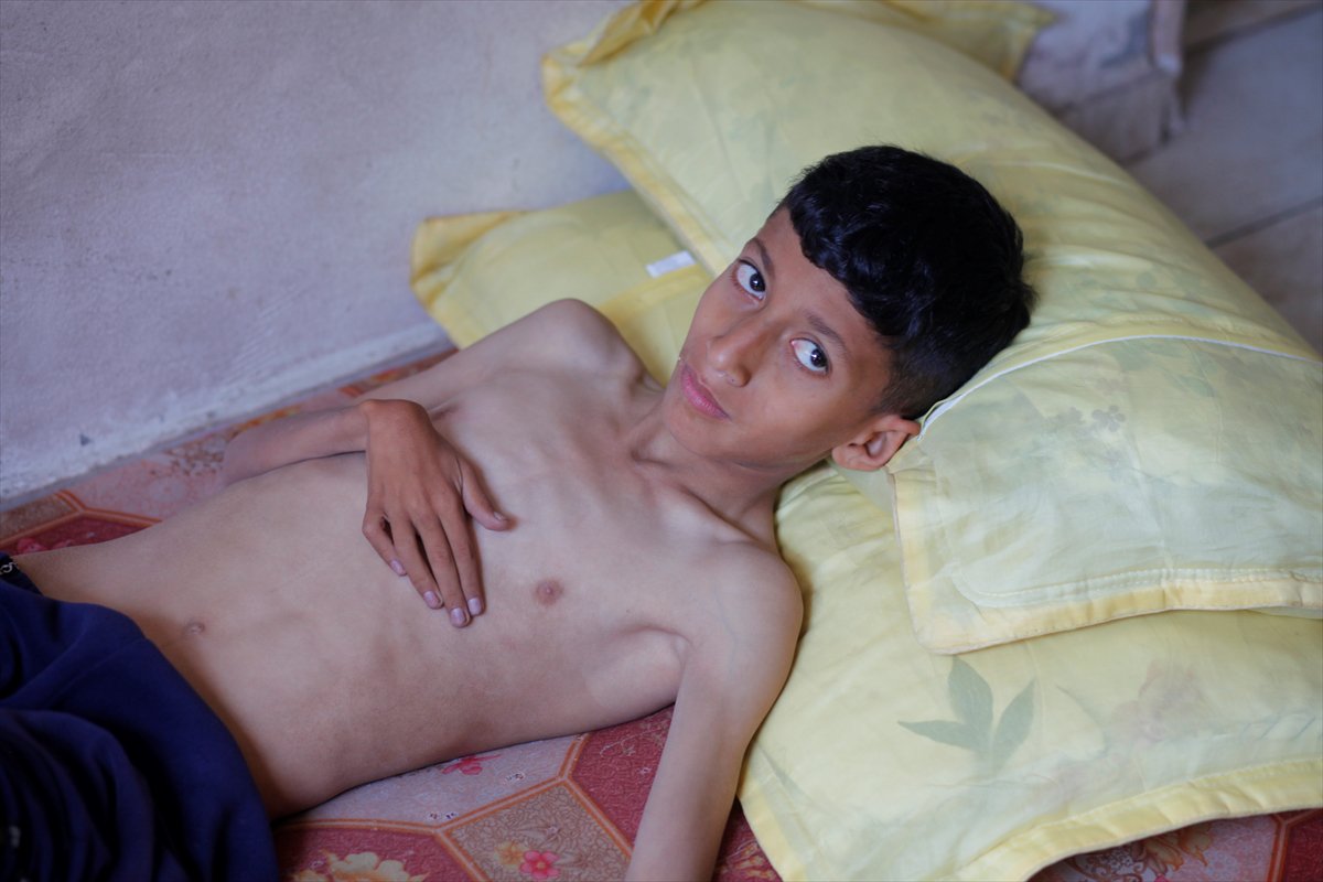 Gazze'de acı tablo: Açlık krizi derinleşiyor