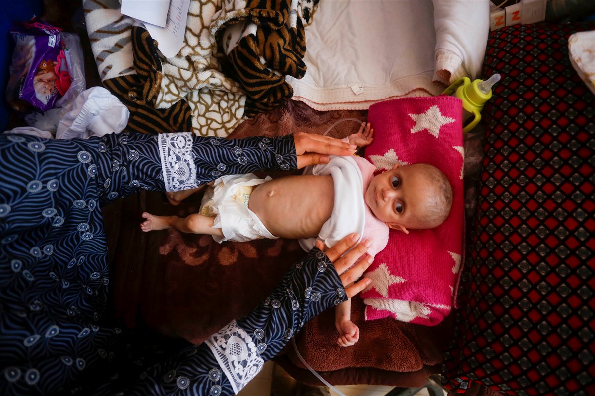 Gazze'de acı tablo: Açlık krizi derinleşiyor