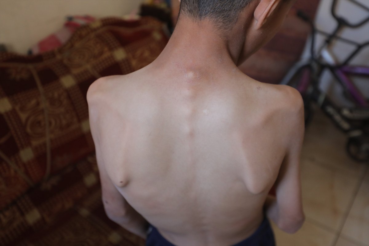 Gazze'de acı tablo: Açlık krizi derinleşiyor