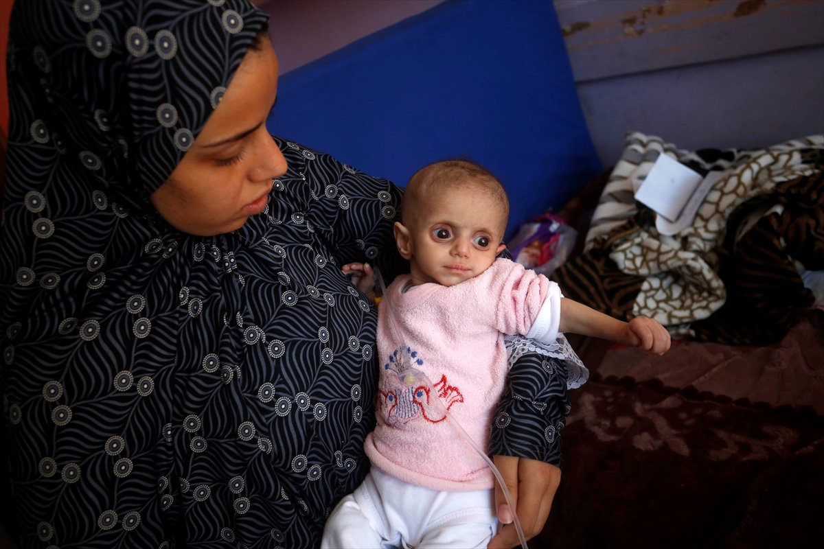 Gazze'de acı tablo: Açlık krizi derinleşiyor