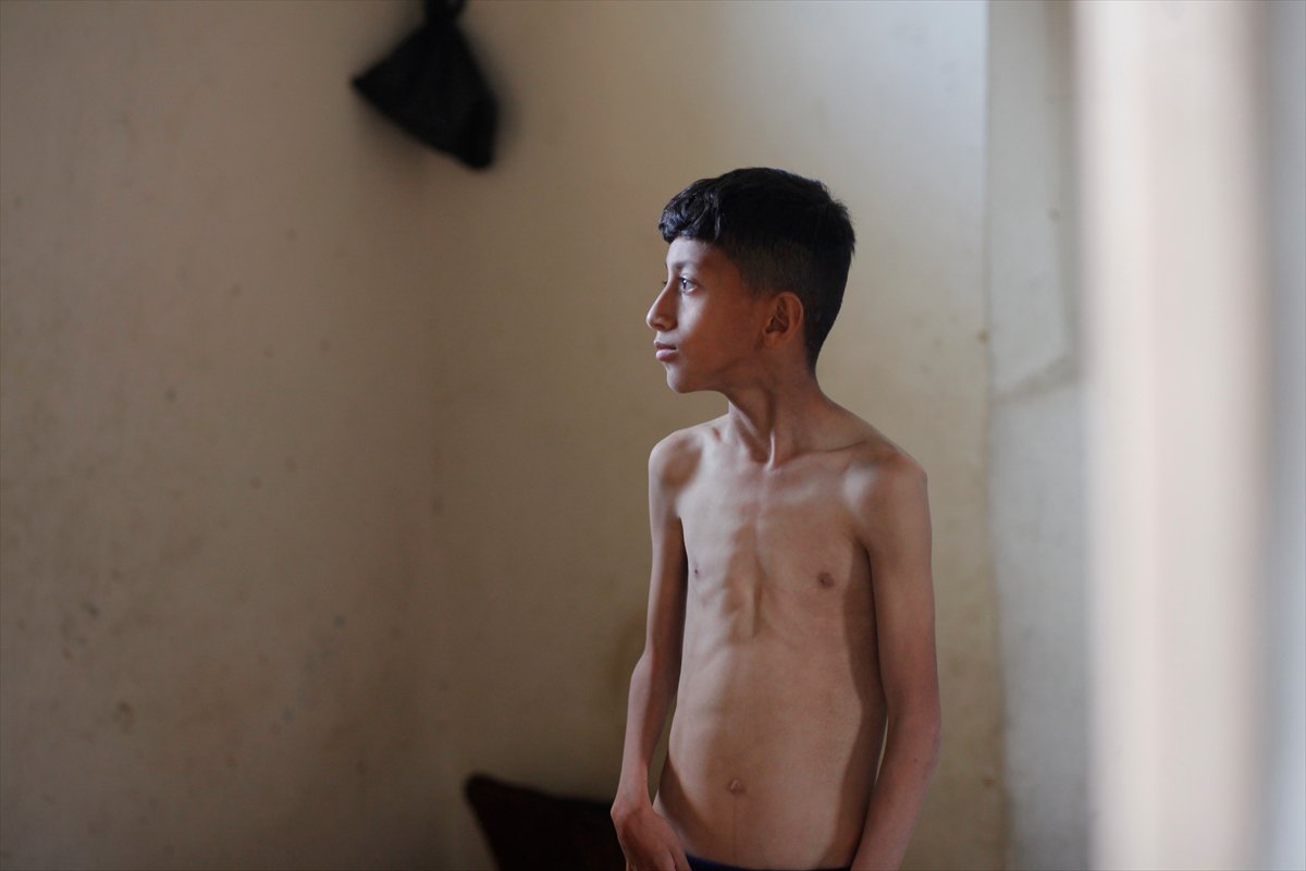 Gazze'de acı tablo: Açlık krizi derinleşiyor