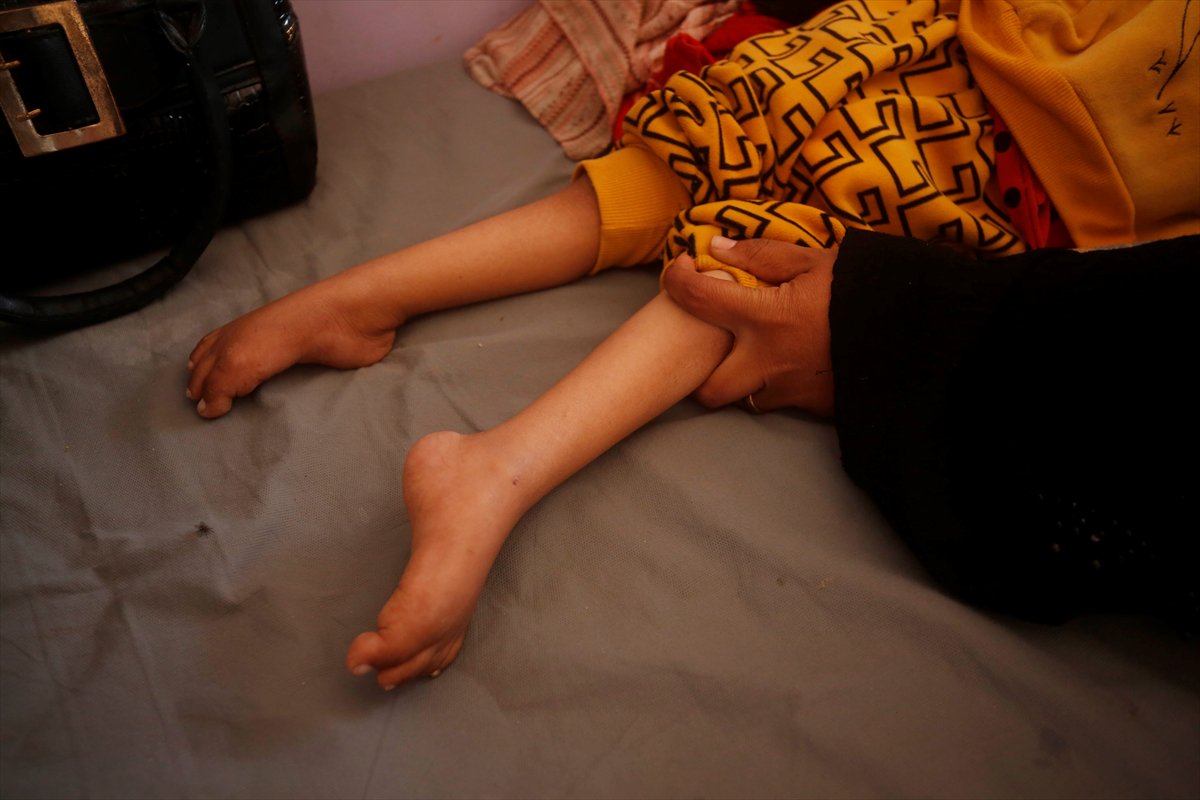 Gazze'de acı tablo: Açlık krizi derinleşiyor