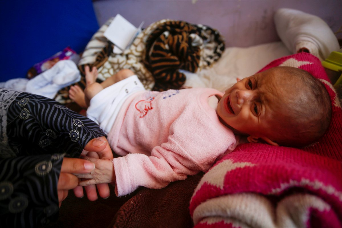 Gazze'de acı tablo: Açlık krizi derinleşiyor