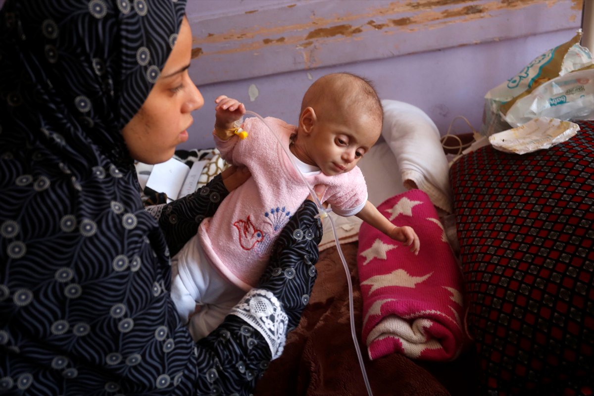 Gazze'de acı tablo: Açlık krizi derinleşiyor