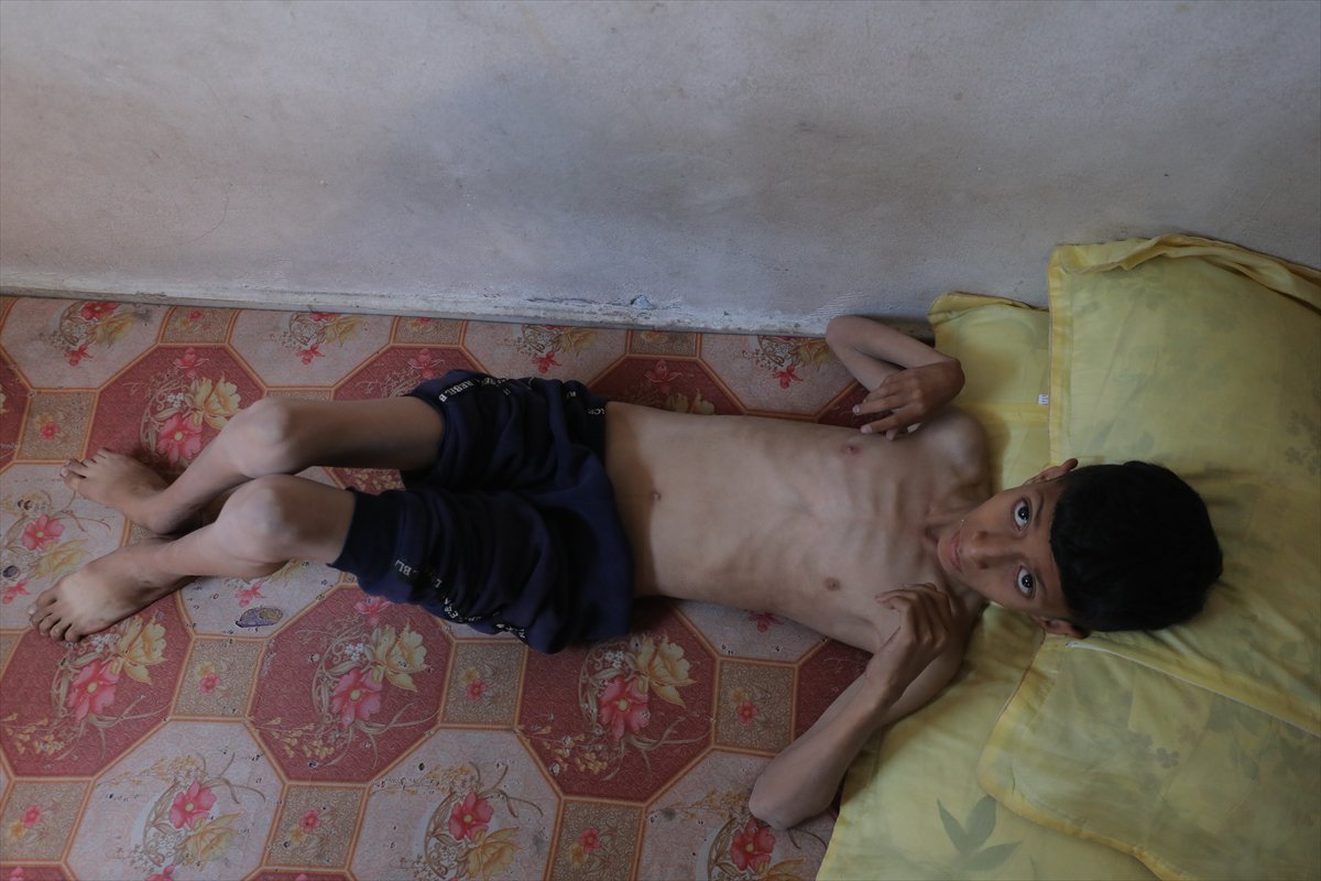 Gazze'de acı tablo: Açlık krizi derinleşiyor