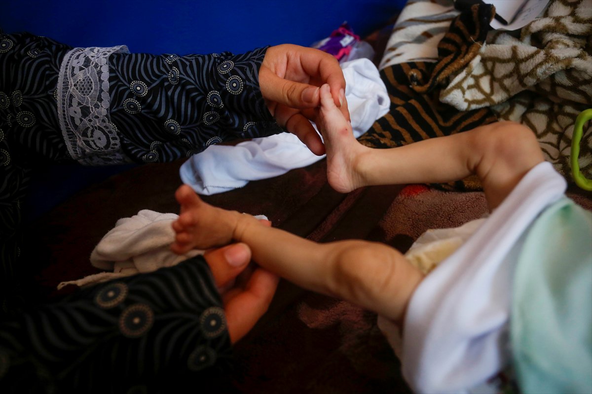 Gazze'de acı tablo: Açlık krizi derinleşiyor