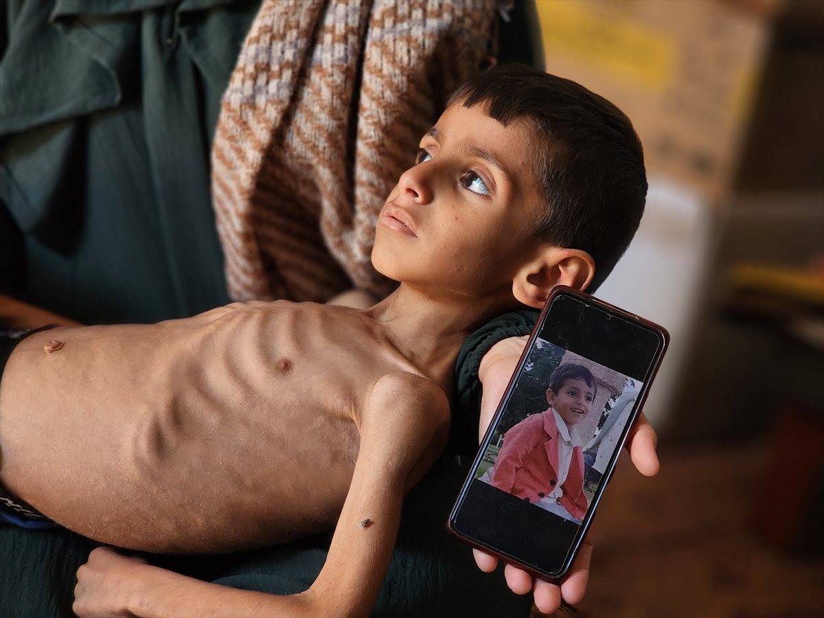 Gazze'de küçük Osama yaşam savaşı veriyor