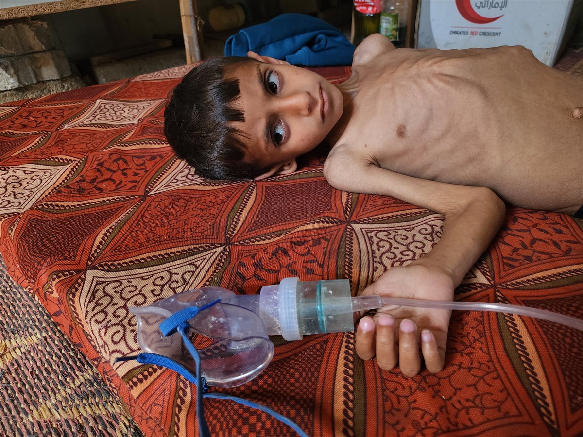 Gazze'de küçük Osama yaşam savaşı veriyor