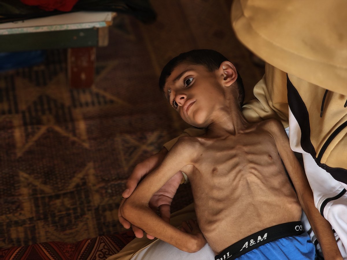 Gazze'de küçük Osama yaşam savaşı veriyor