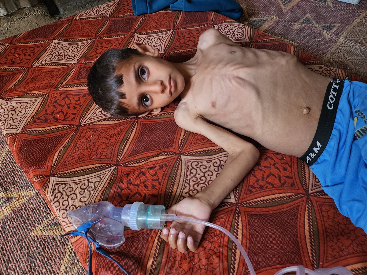 Gazze'de küçük Osama yaşam savaşı veriyor