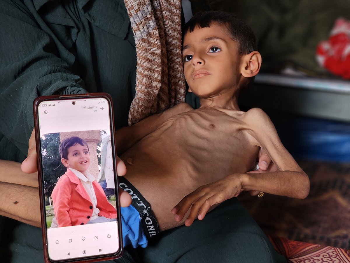 Gazze'de küçük Osama yaşam savaşı veriyor